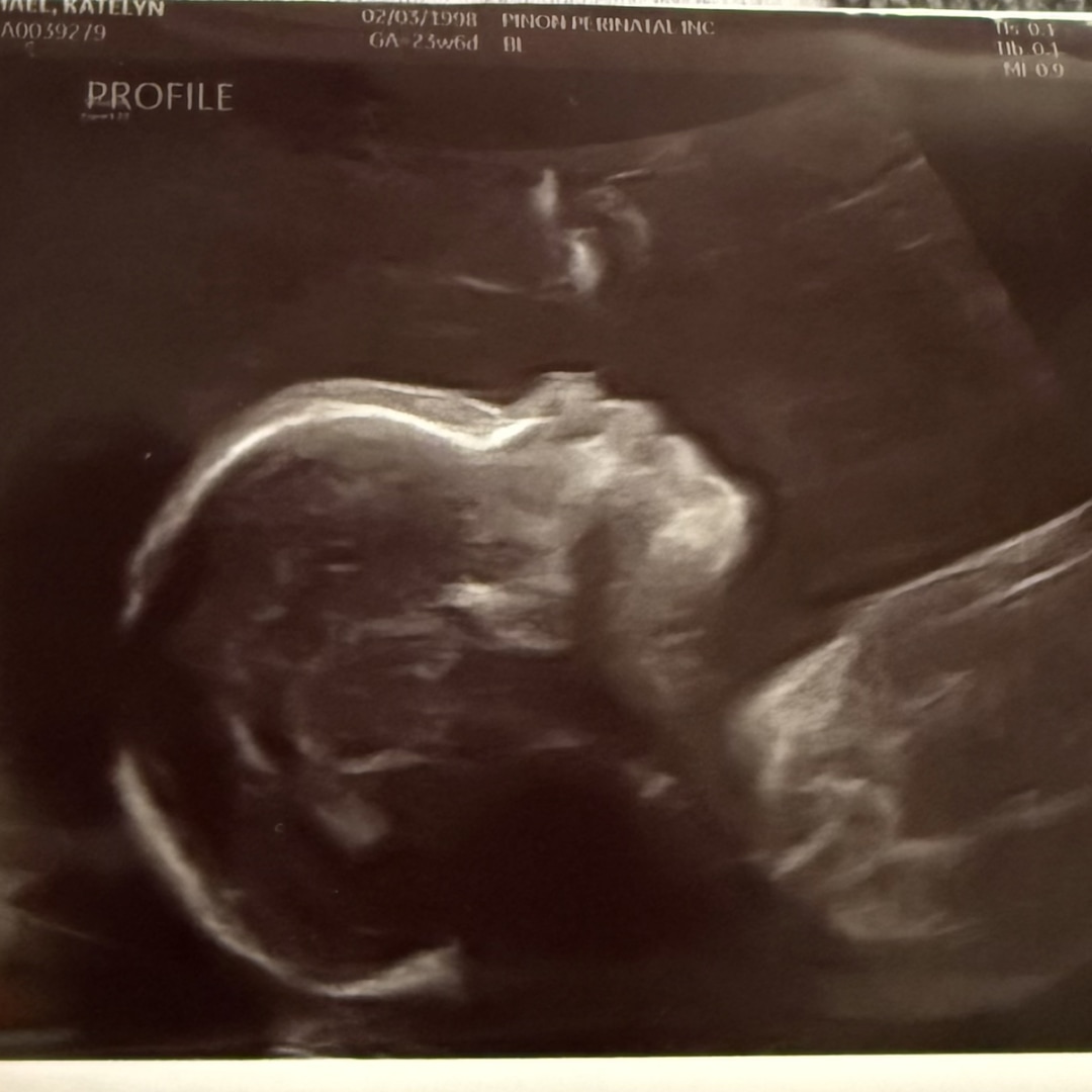 Photo shared by Katelyn for their Babylist baby registry.