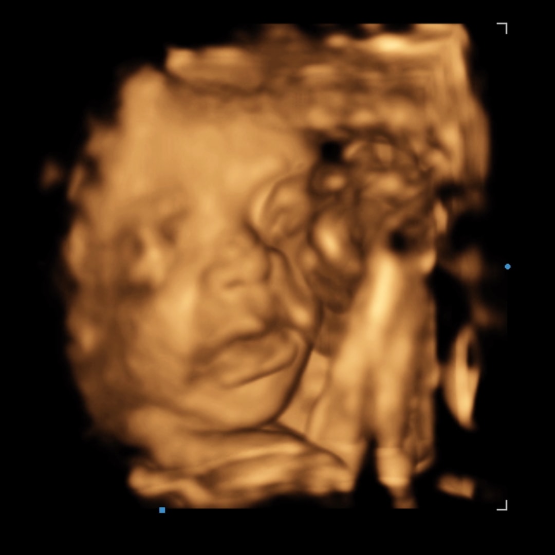 Photo shared by Alexis for their Babylist baby registry.