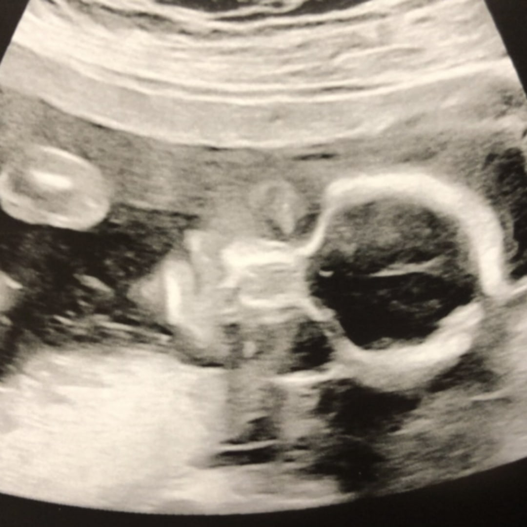 Photo shared by Alora for their Babylist baby registry.