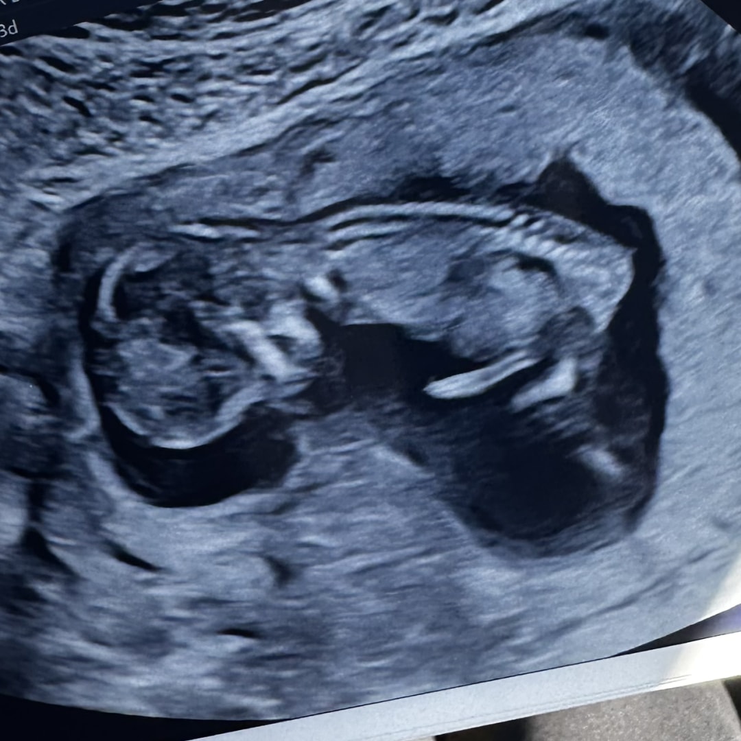 Photo shared by Jennifer for their Babylist baby registry.