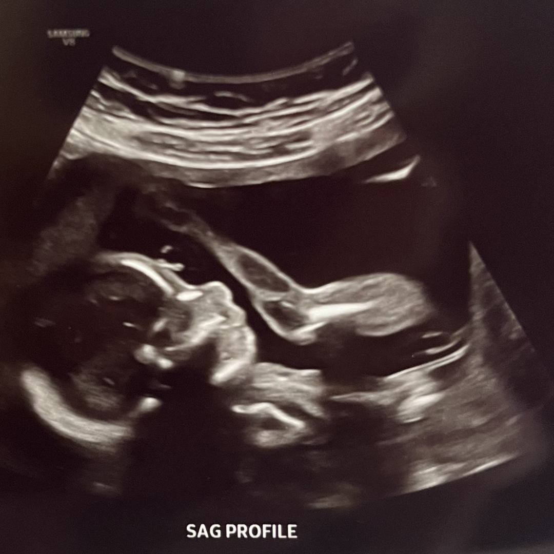 Photo shared by Haley for their Babylist baby registry.