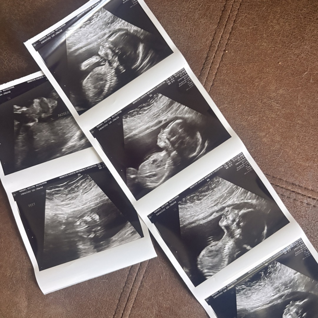 Photo shared by Joclyn for their Babylist baby registry.