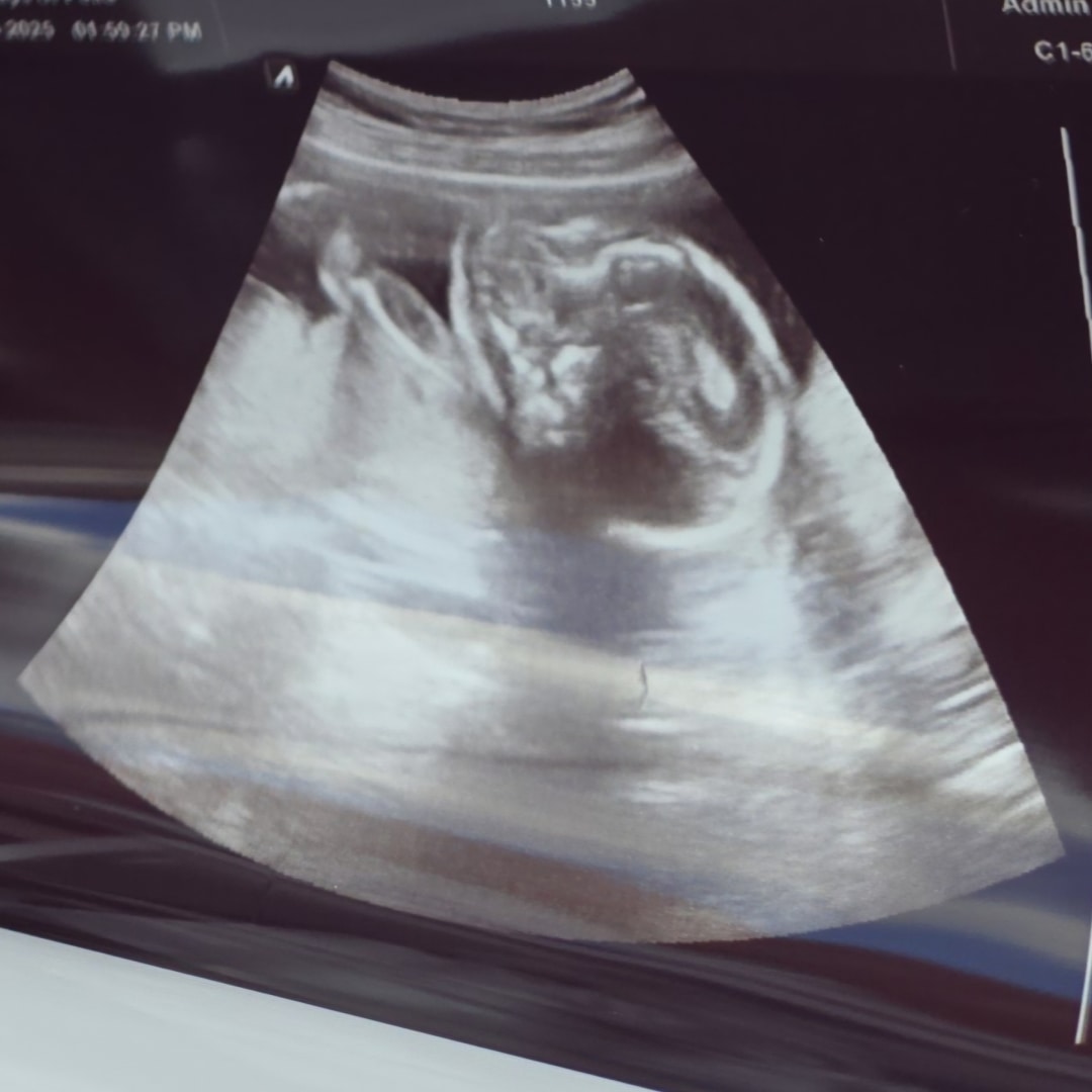 Photo shared by Claudia for their Babylist baby registry.