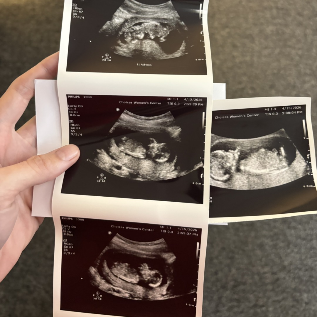 Photo shared by Cassandra for their Babylist baby registry.