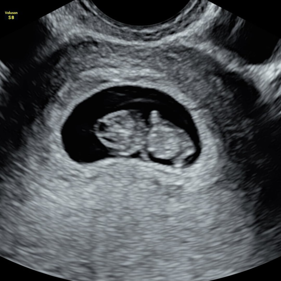 Photo shared by Haley for their Babylist baby registry.