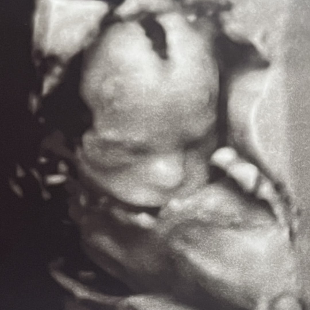 Photo shared by Molly for their Babylist baby registry.