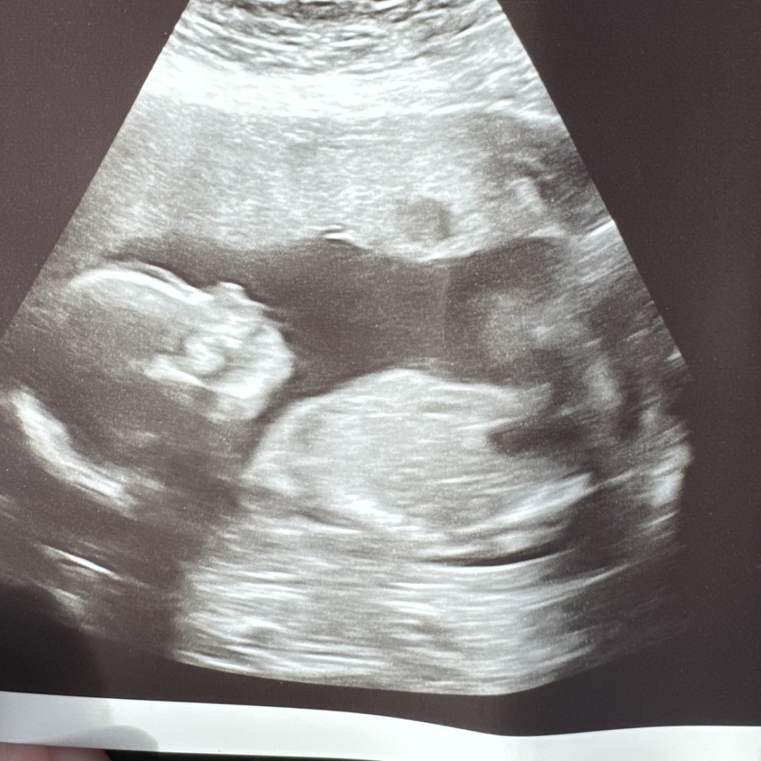 Photo shared by Casey for their Babylist baby registry.