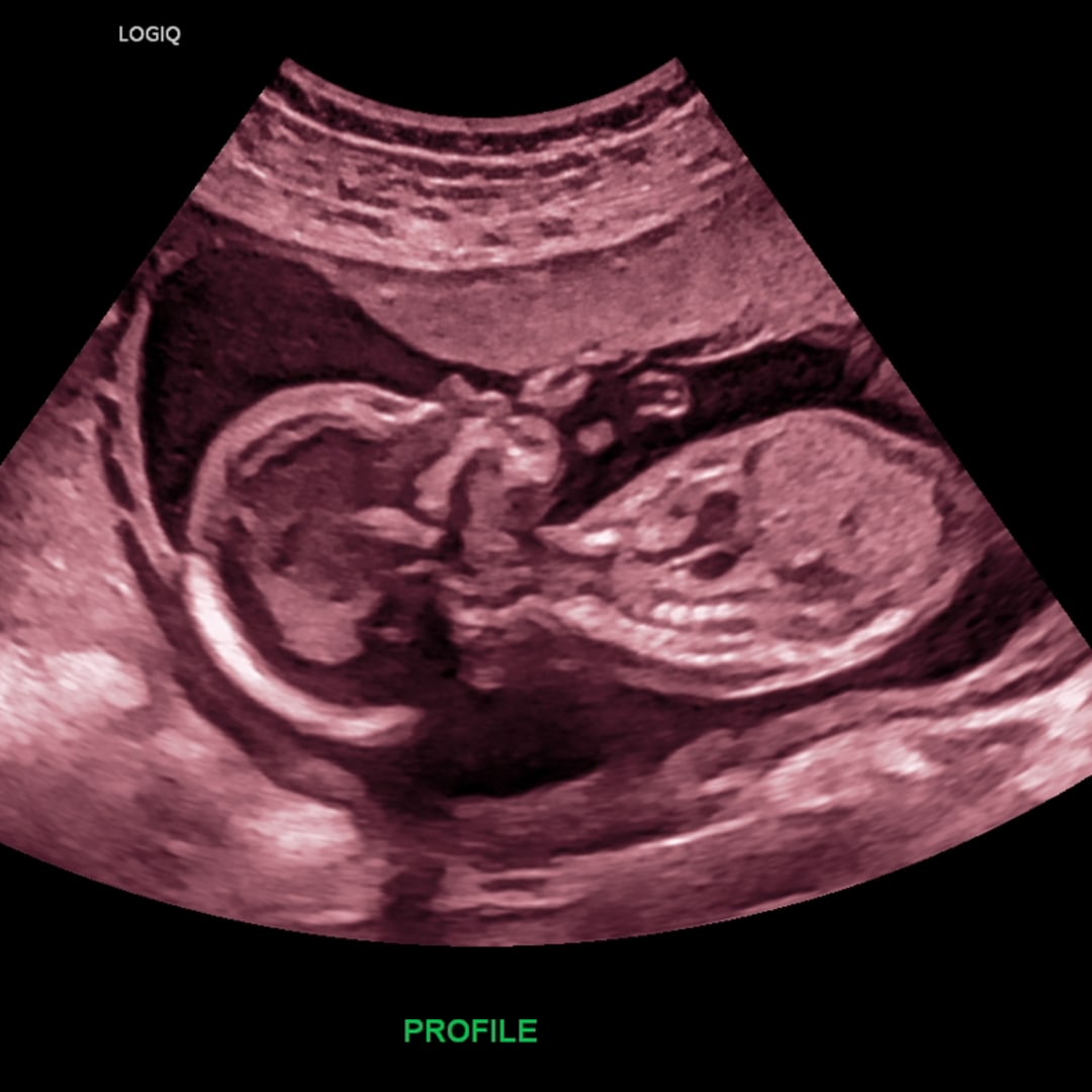 Photo shared by Blaize for their Babylist baby registry.