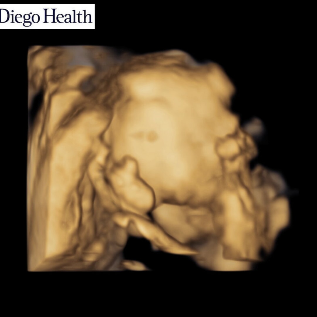 Photo shared by Lizbeth for their Babylist baby registry.