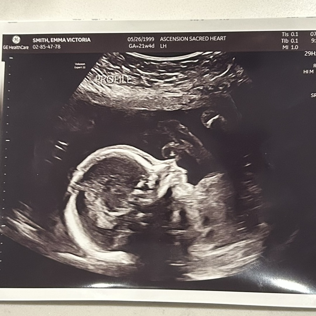 Photo shared by Emma-Caroline for their Babylist baby registry.