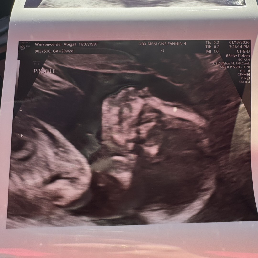 Photo shared by Abigail for their Babylist baby registry.