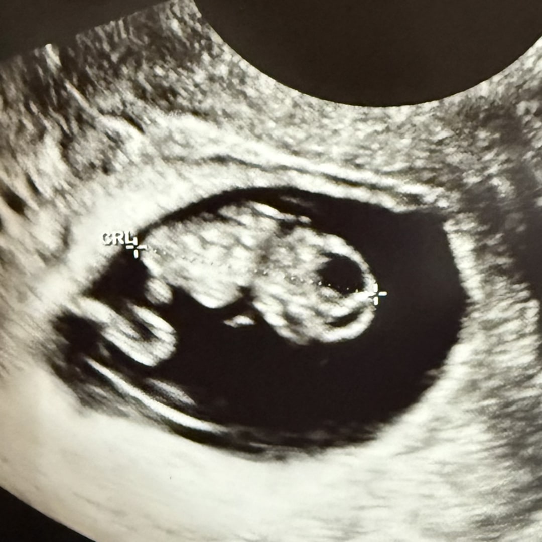 Photo shared by Bonny for their Babylist baby registry.