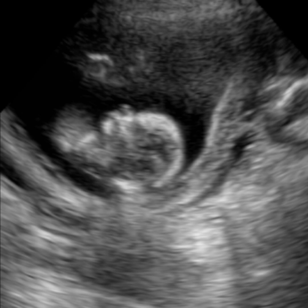 Photo shared by Katelyn for their Babylist baby registry.