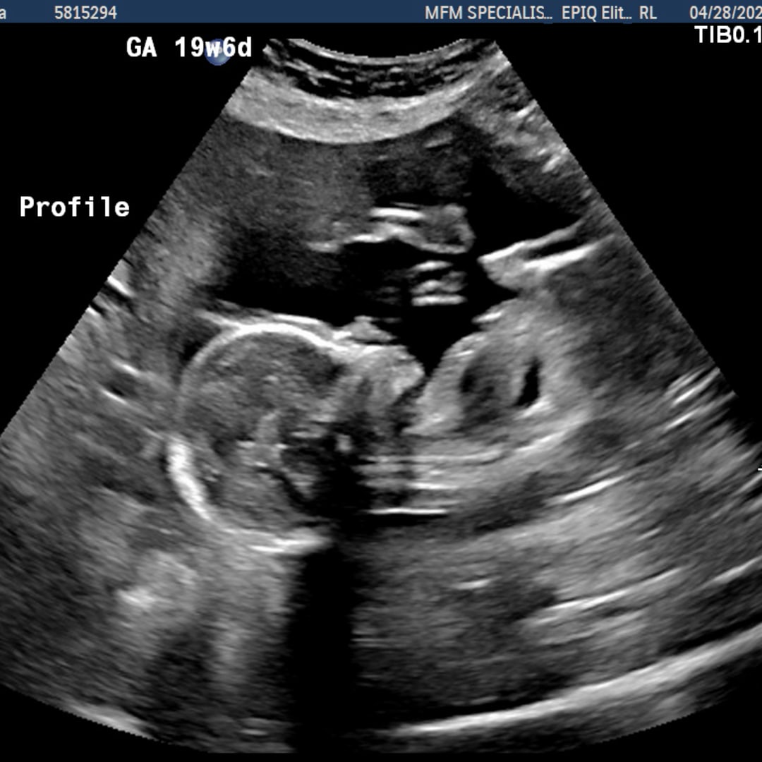 Photo shared by Bianca for their Babylist baby registry.