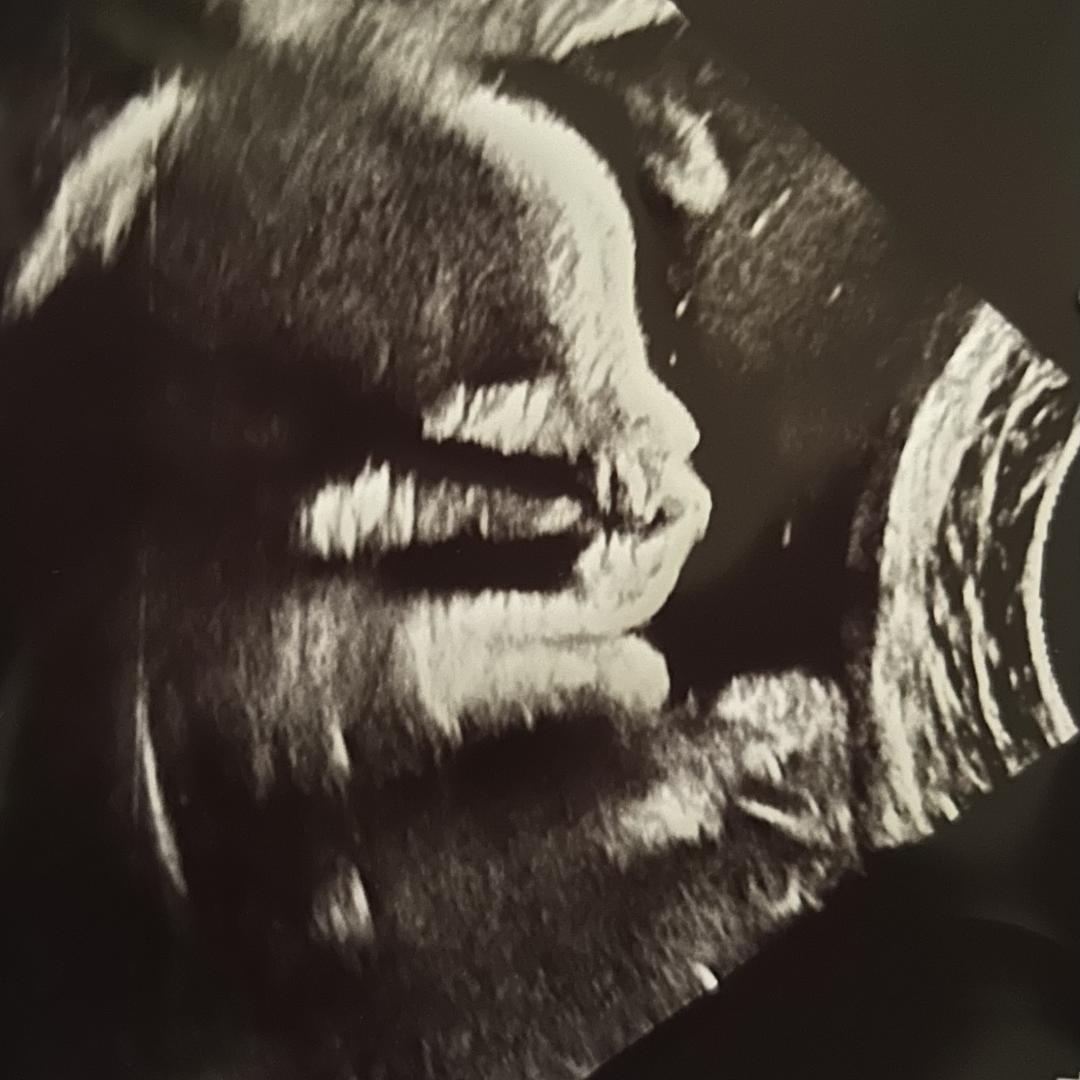Photo shared by Isabella for their Babylist baby registry.