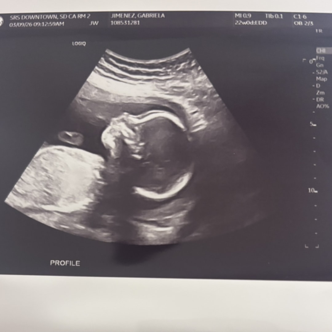 Photo shared by Gabriela for their Babylist baby registry.