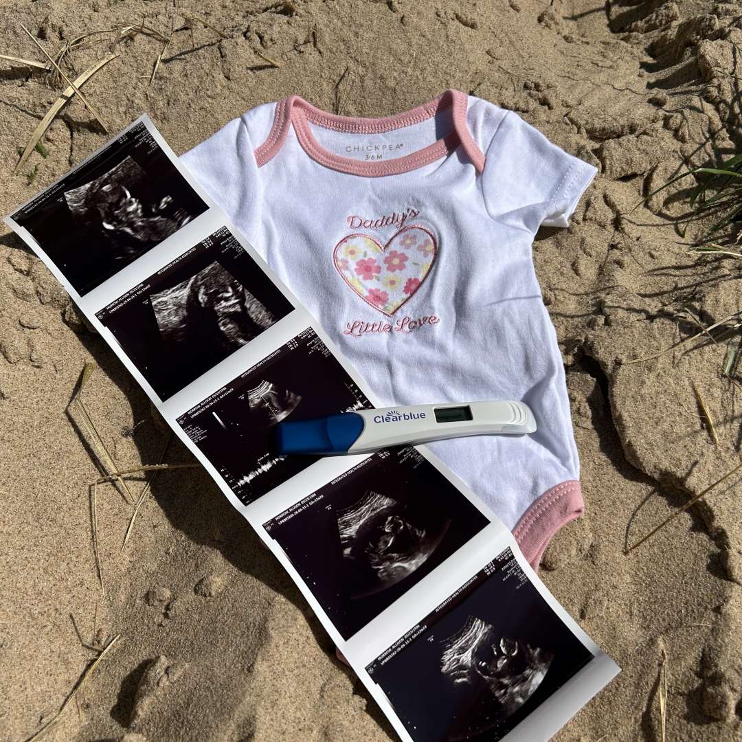 Photo shared by Allison for their Babylist baby registry.