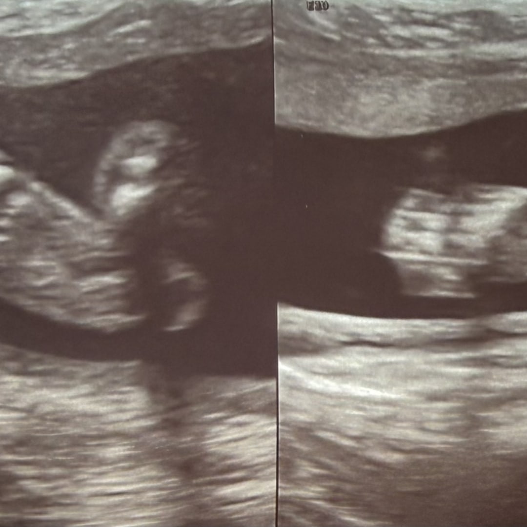 Photo shared by Anna for their Babylist baby registry.