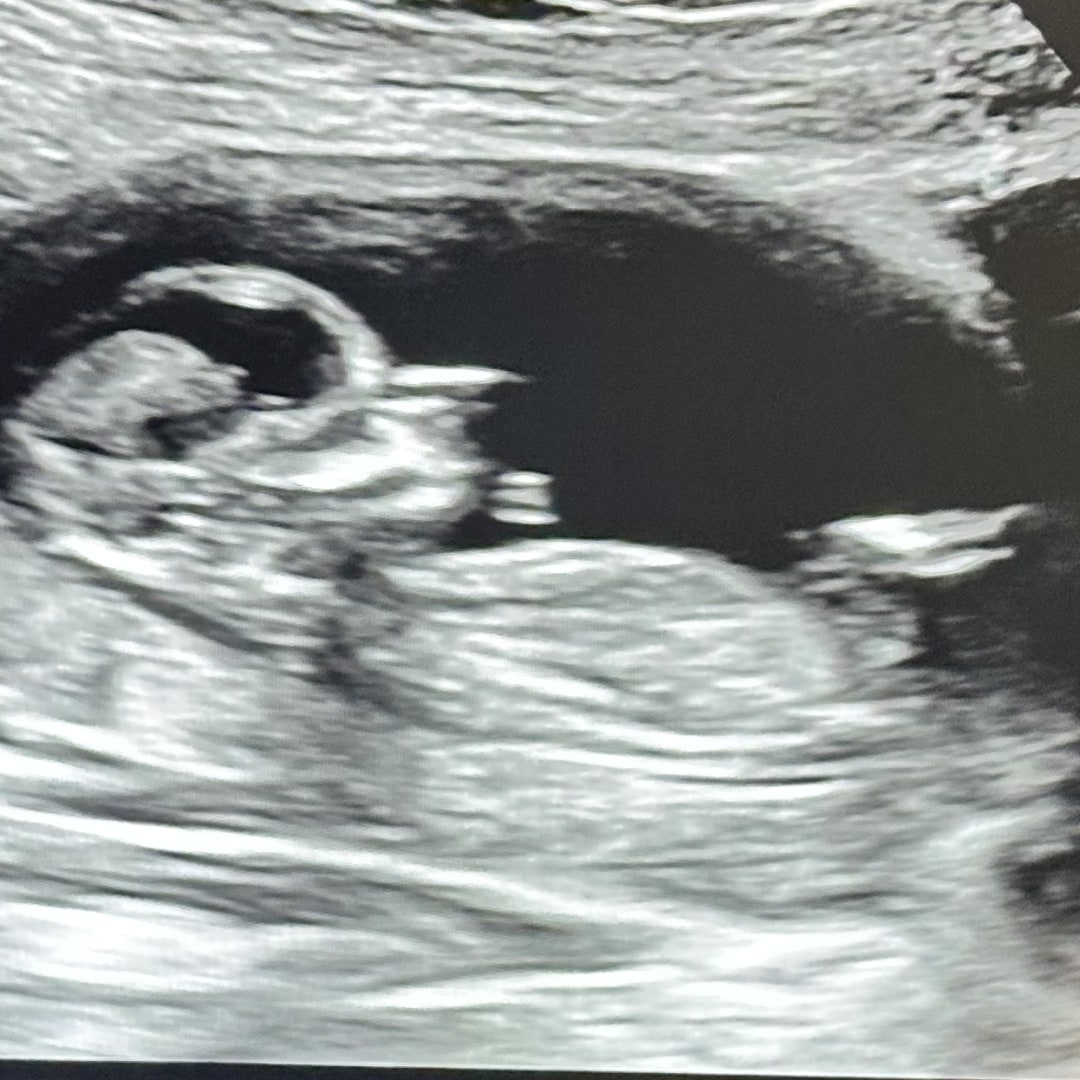 Photo shared by Haley for their Babylist baby registry.