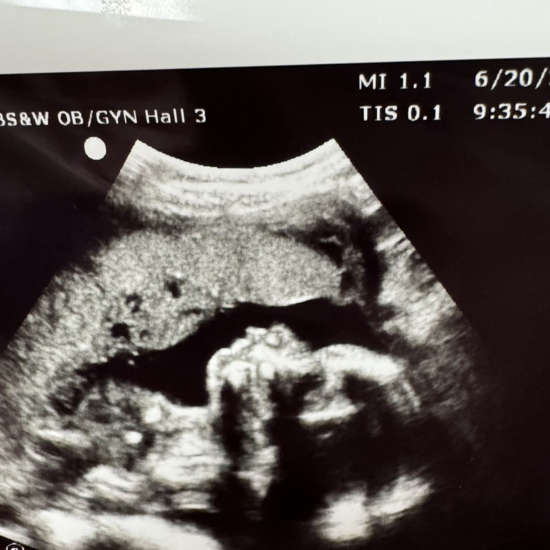 Photo shared by Callie for their Babylist baby registry.