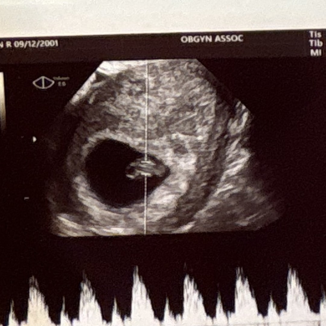 Photo shared by Ashlan for their Babylist baby registry.