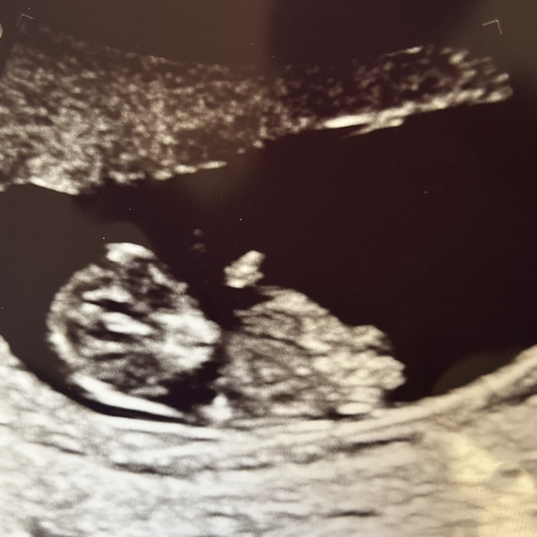 Photo shared by Kyleigh for their Babylist baby registry.