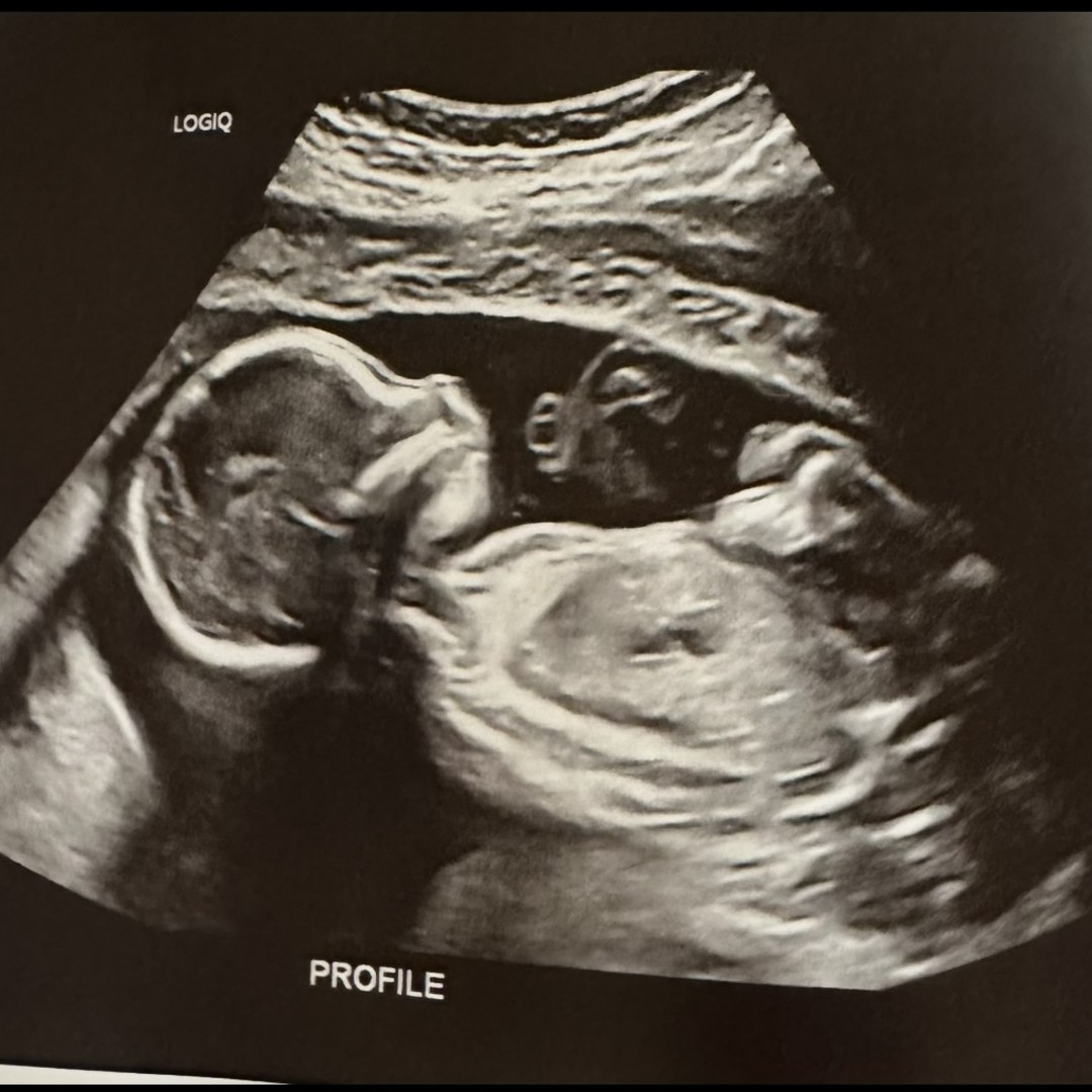 Photo shared by Holly for their Babylist baby registry.