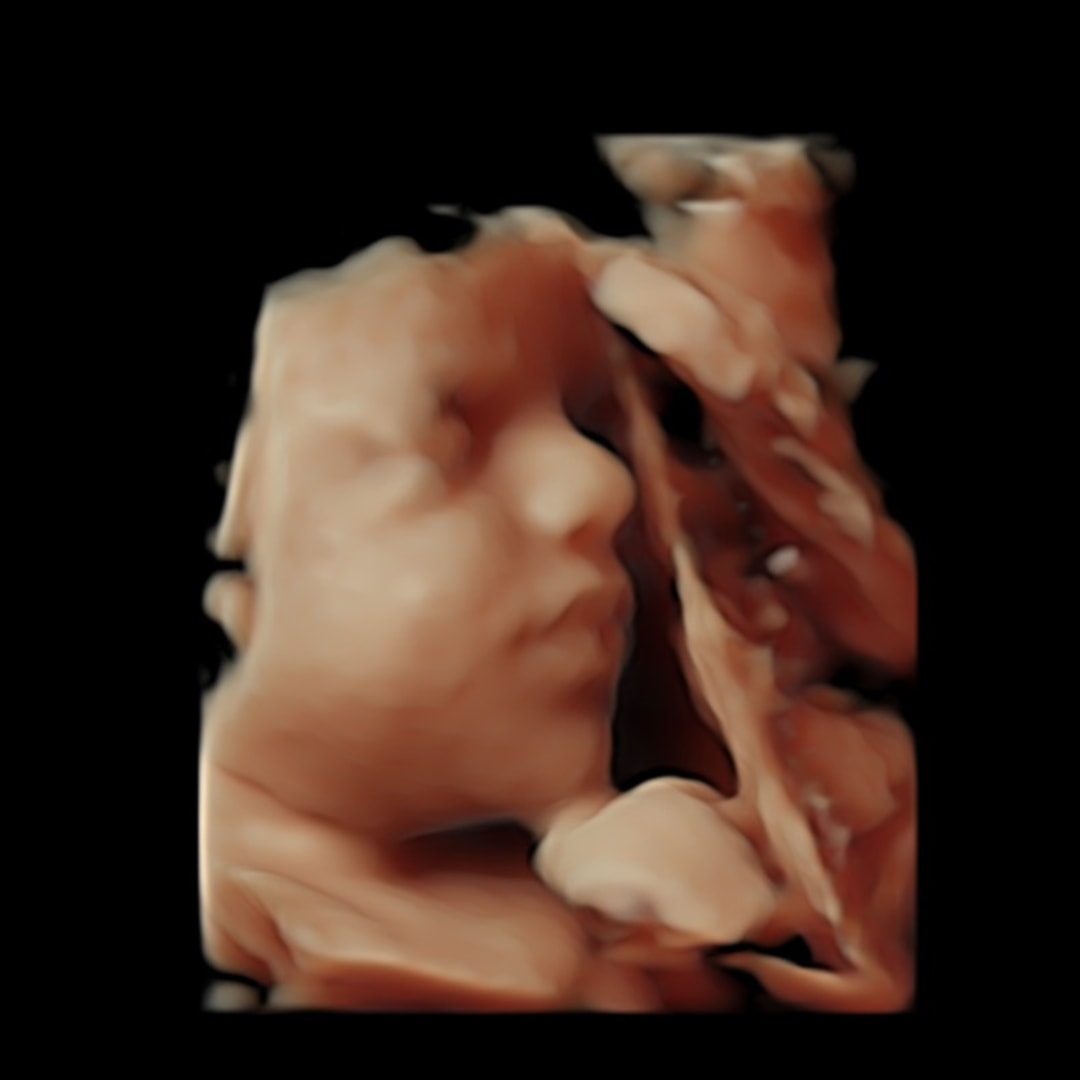 Photo shared by Brianna for their Babylist baby registry.