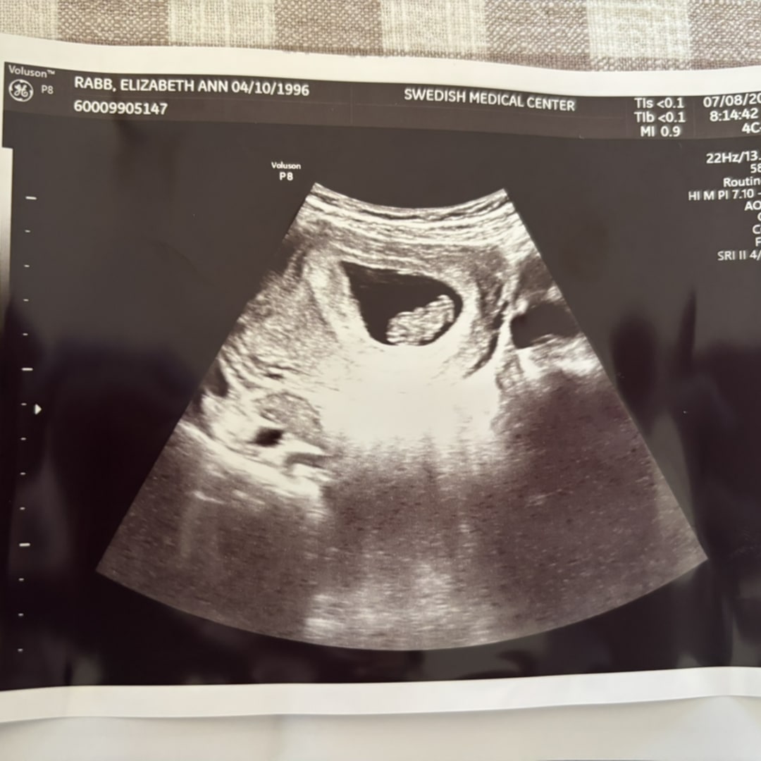 Photo shared by Elise for their Babylist baby registry.
