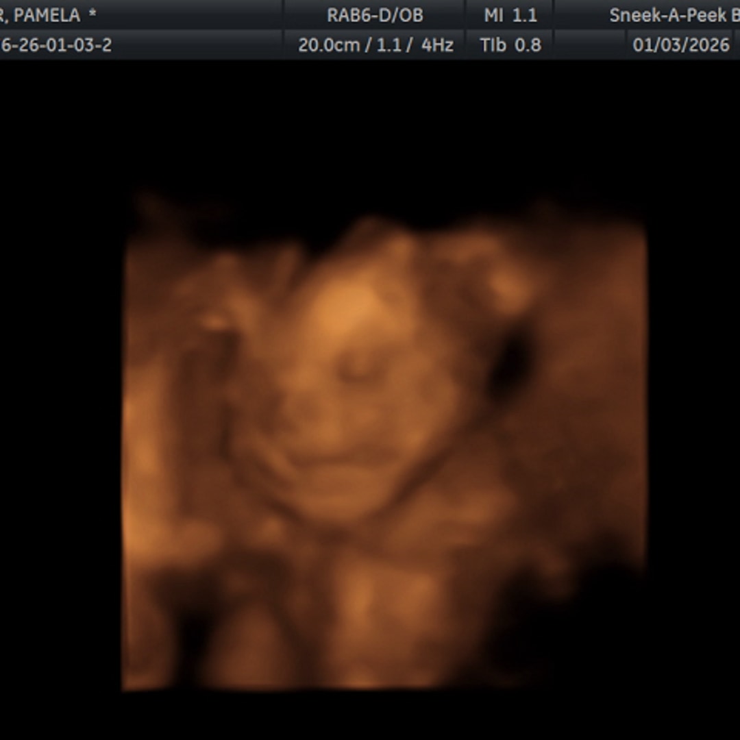 Photo shared by Pamela for their Babylist baby registry.