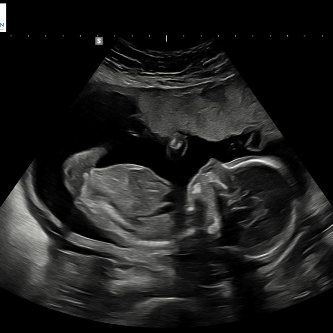 Photo shared by Allison for their Babylist baby registry.