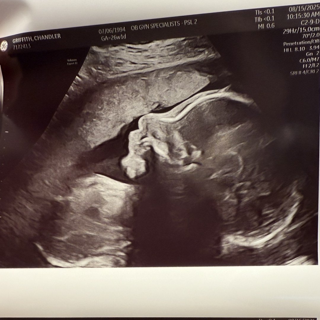 Photo shared by Chandler for their Babylist baby registry.