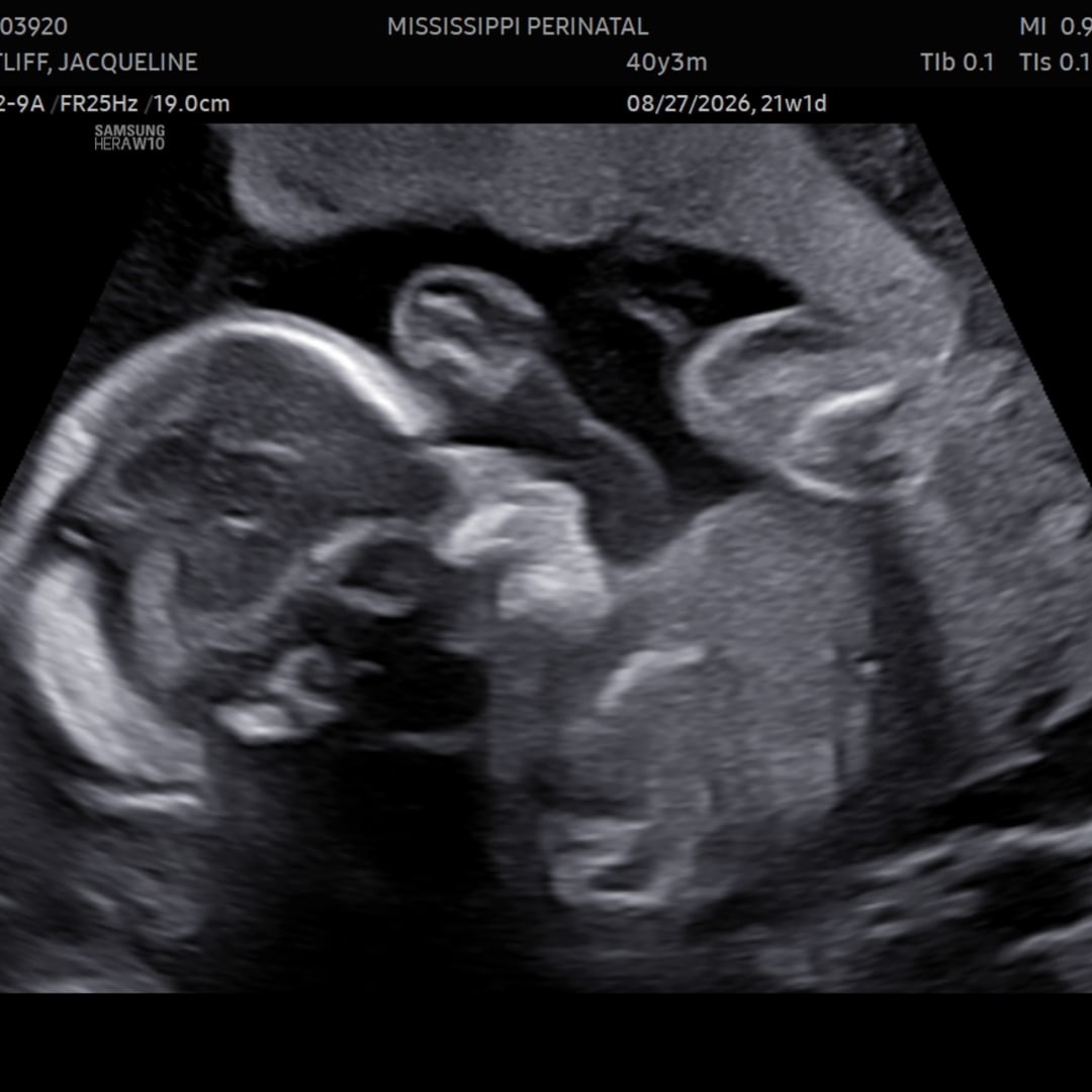 Photo shared by Jackie for their Babylist baby registry.