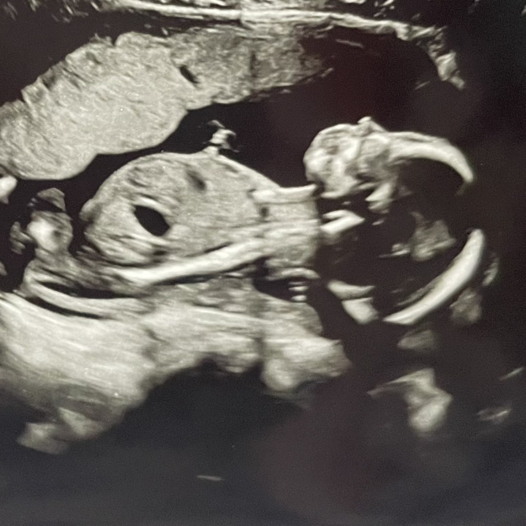 Photo shared by Gabriella for their Babylist baby registry.