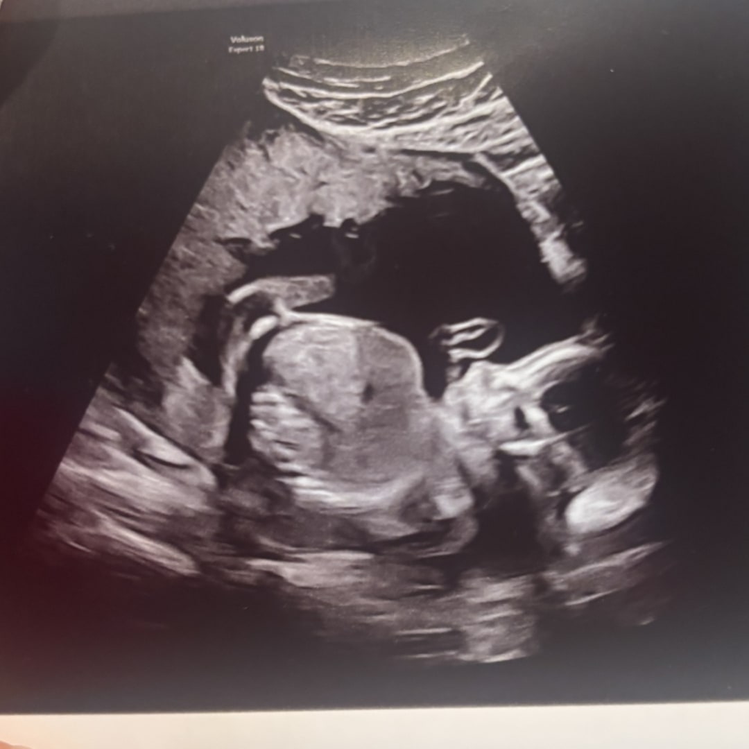 Photo shared by Madi for their Babylist baby registry.