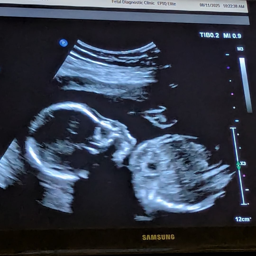 Photo shared by Yolanda for their Babylist baby registry.