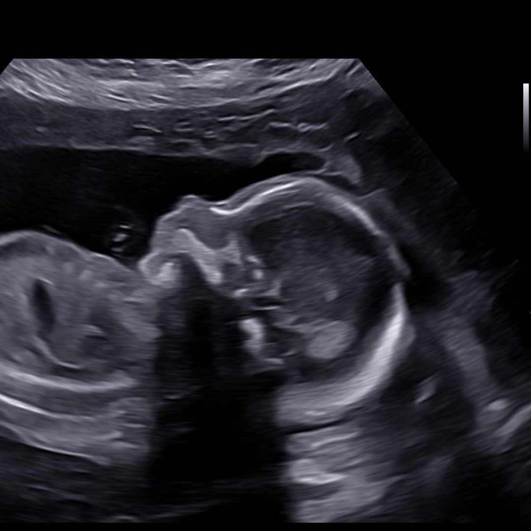 Photo shared by Amisha for their Babylist baby registry.