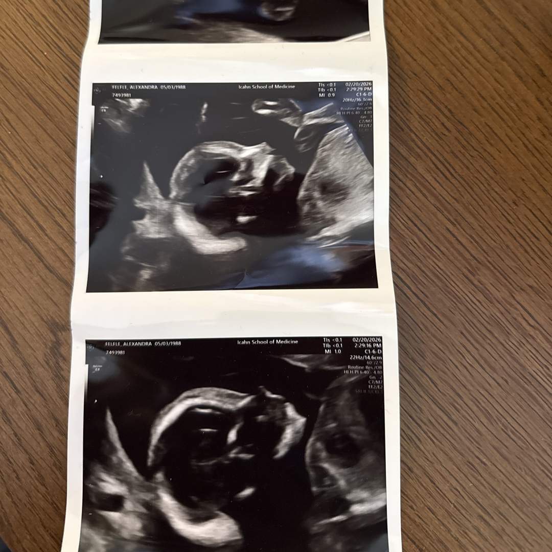 Photo shared by Alexandra for their Babylist baby registry.