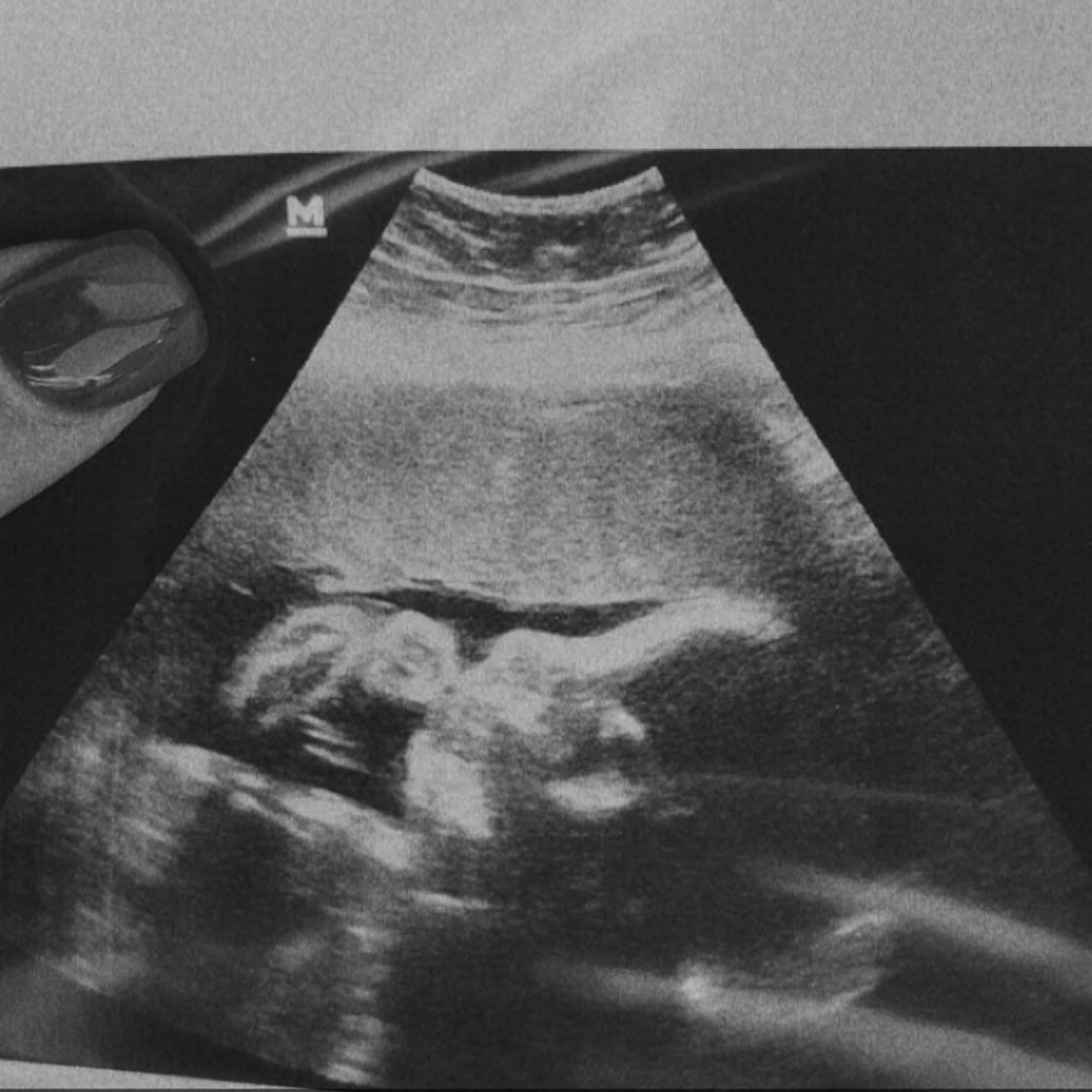 Photo shared by Gabriela for their Babylist baby registry.