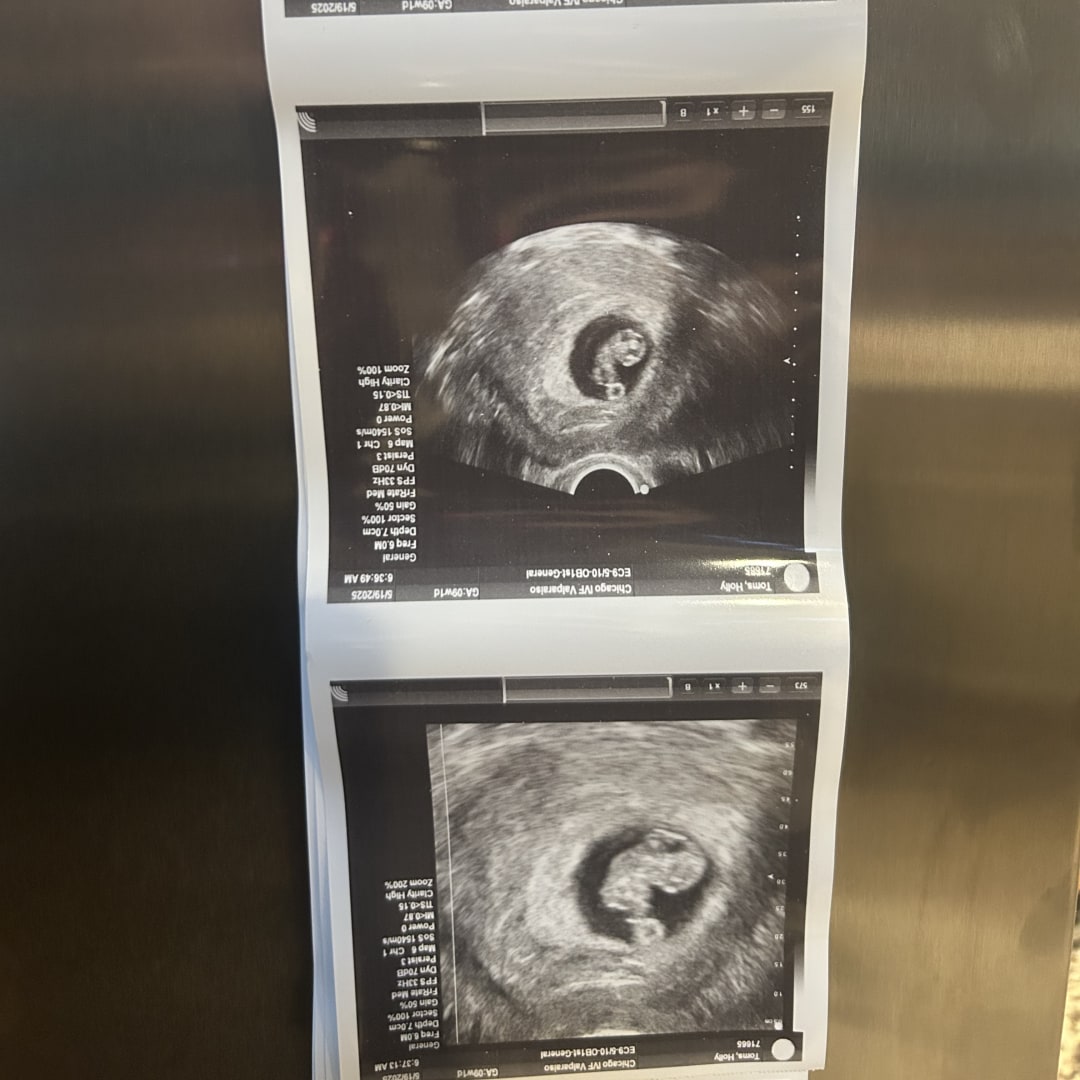 Photo shared by Holly for their Babylist baby registry.