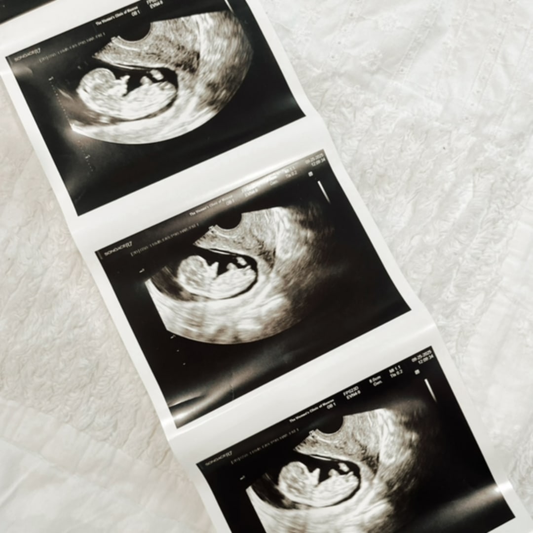 Photo shared by Cloe for their Babylist baby registry.