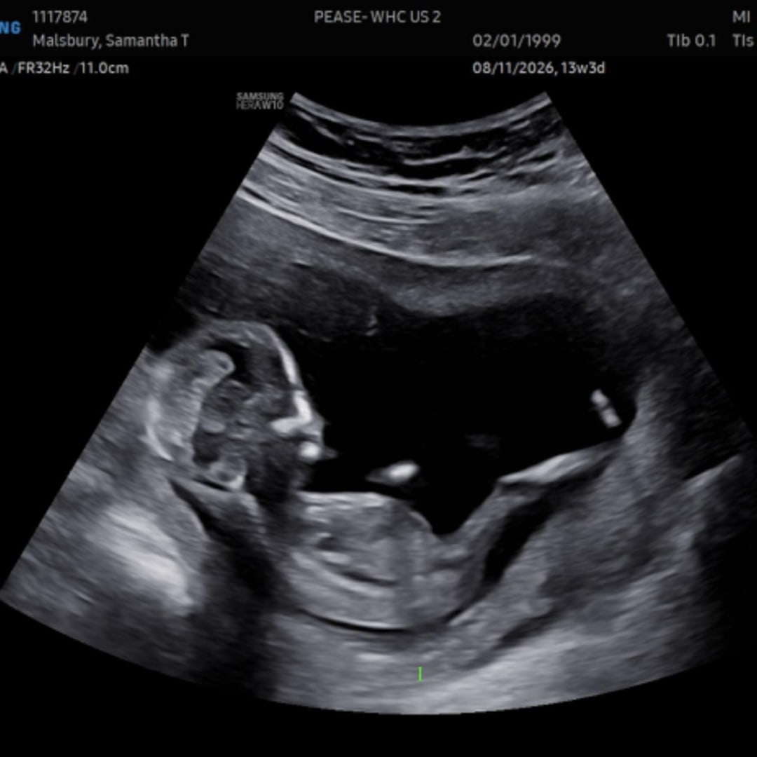 Photo shared by Samantha for their Babylist baby registry.