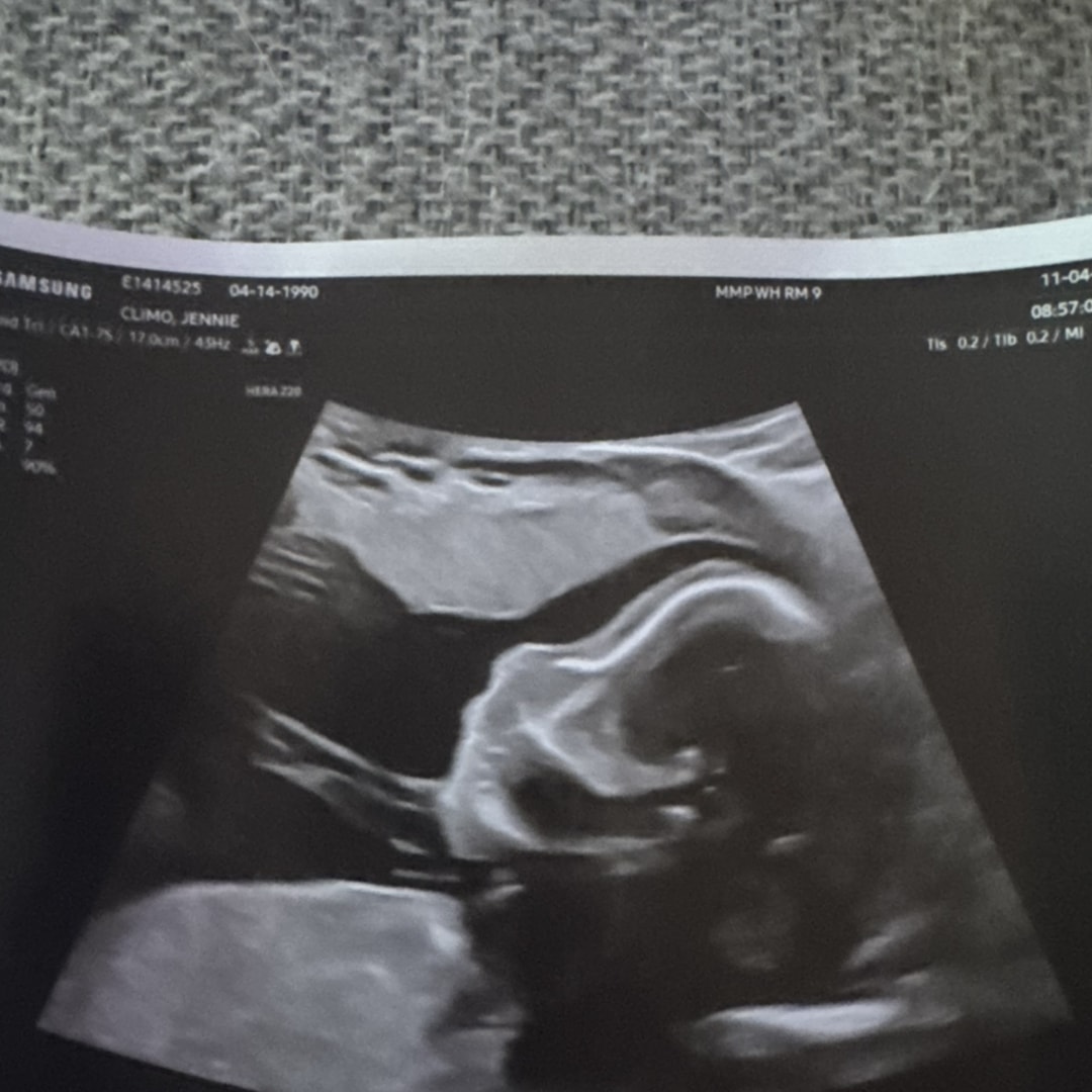 Photo shared by Jennie for their Babylist baby registry.