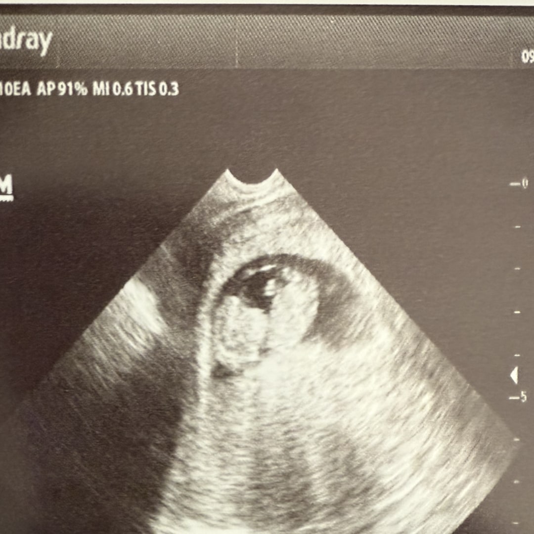 Photo shared by Sierra for their Babylist baby registry.