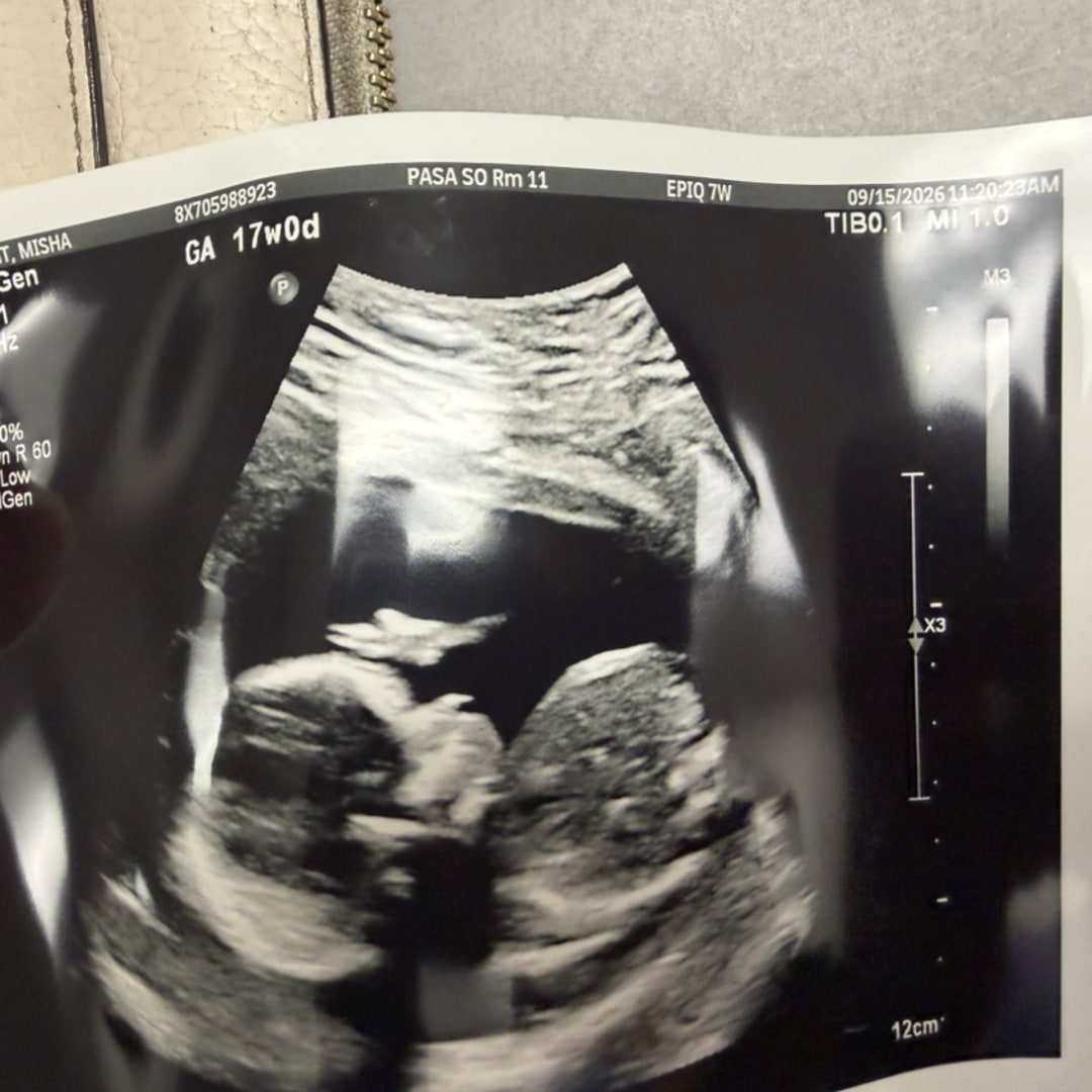 Photo shared by Tyrone for their Babylist baby registry.