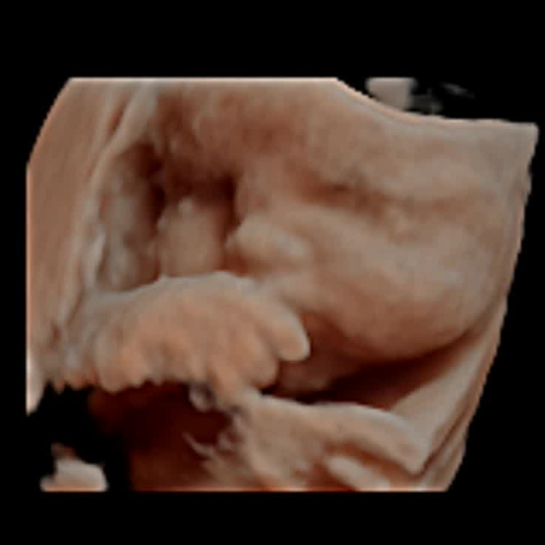 Photo shared by Emily for their Babylist baby registry.