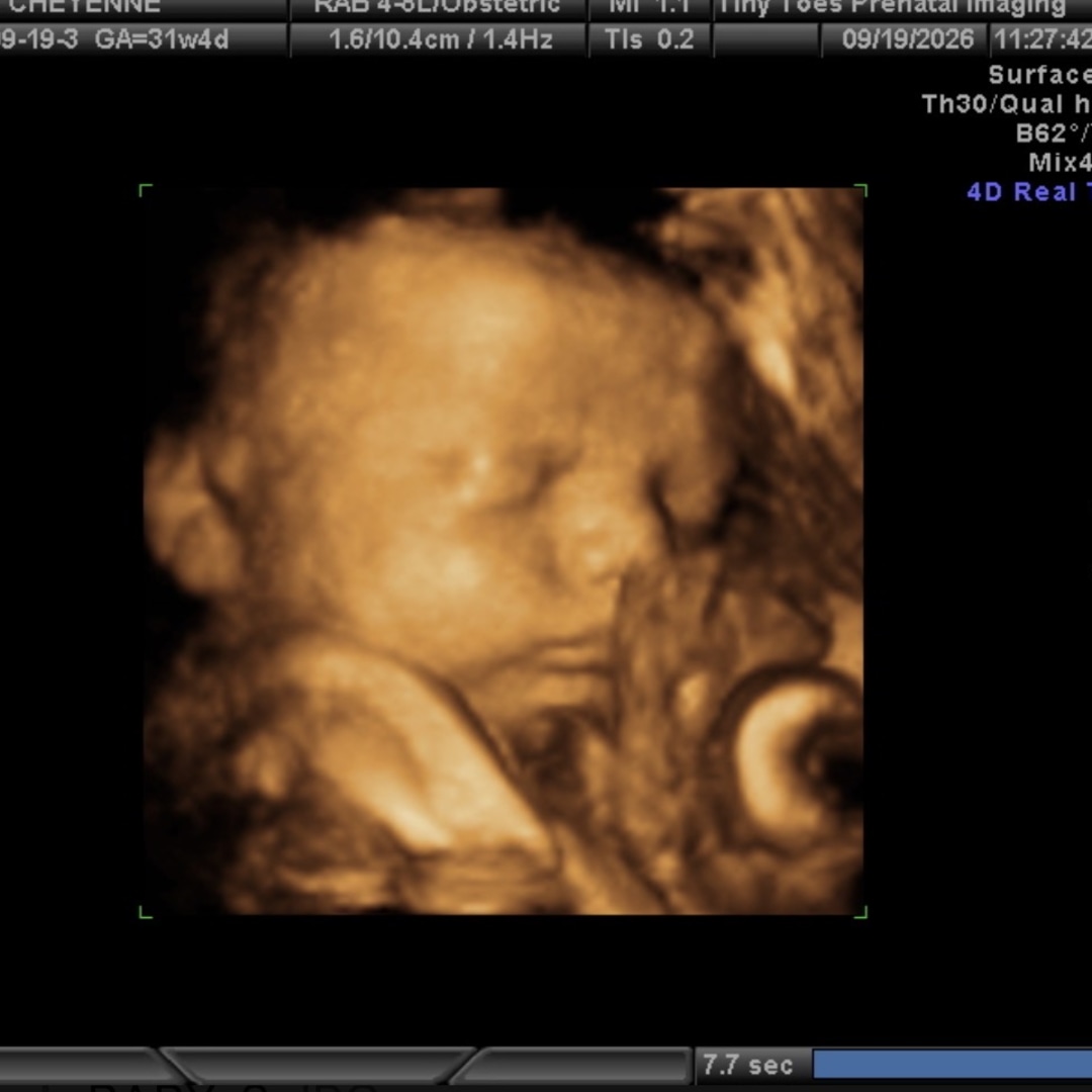 Photo shared by Cheyenne for their Babylist baby registry.