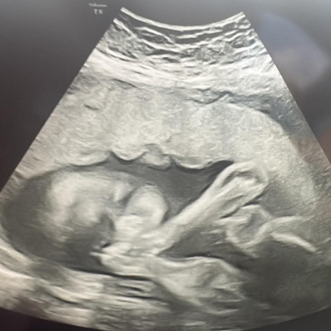Photo shared by Alexandria for their Babylist baby registry.