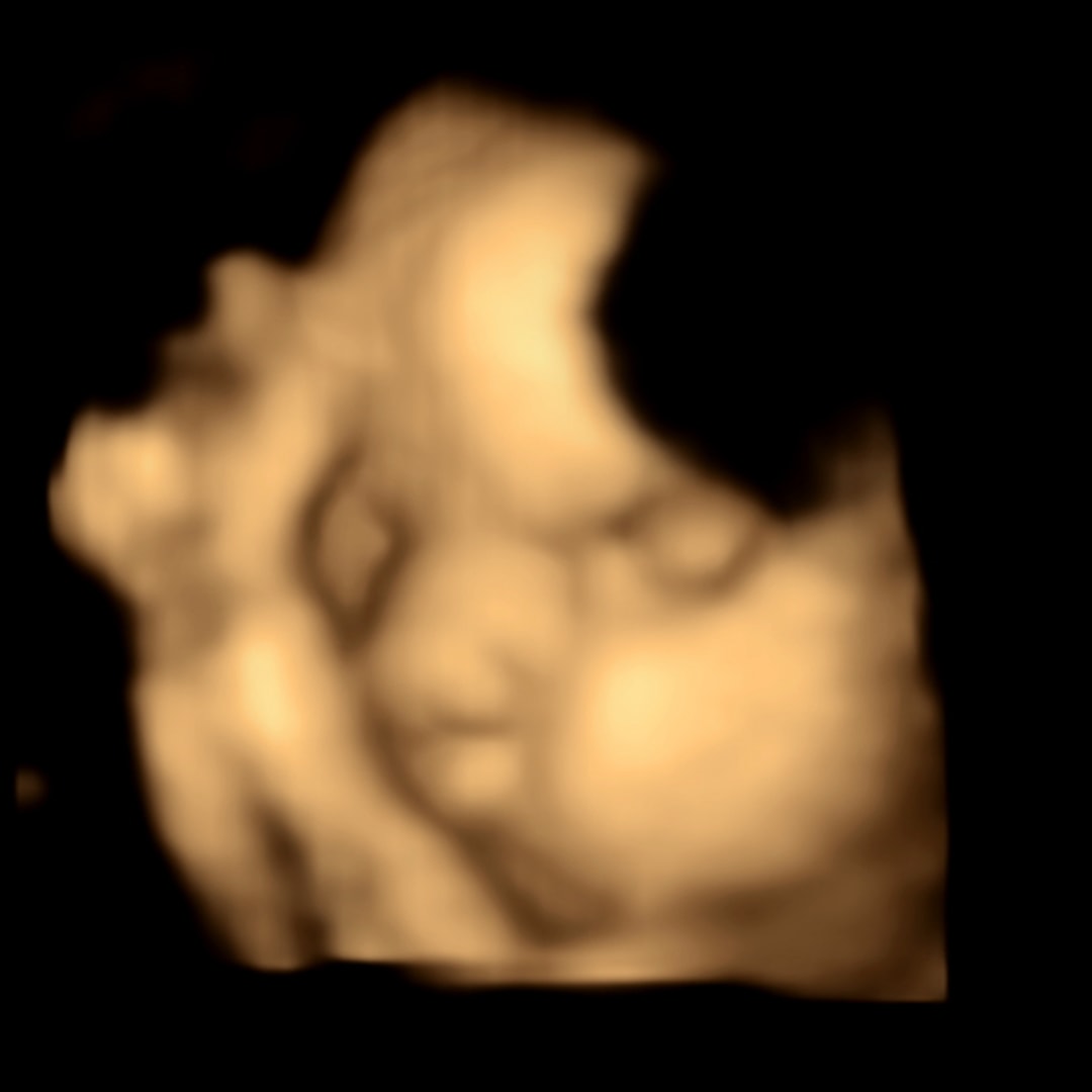 Photo shared by Hunter for their Babylist baby registry.