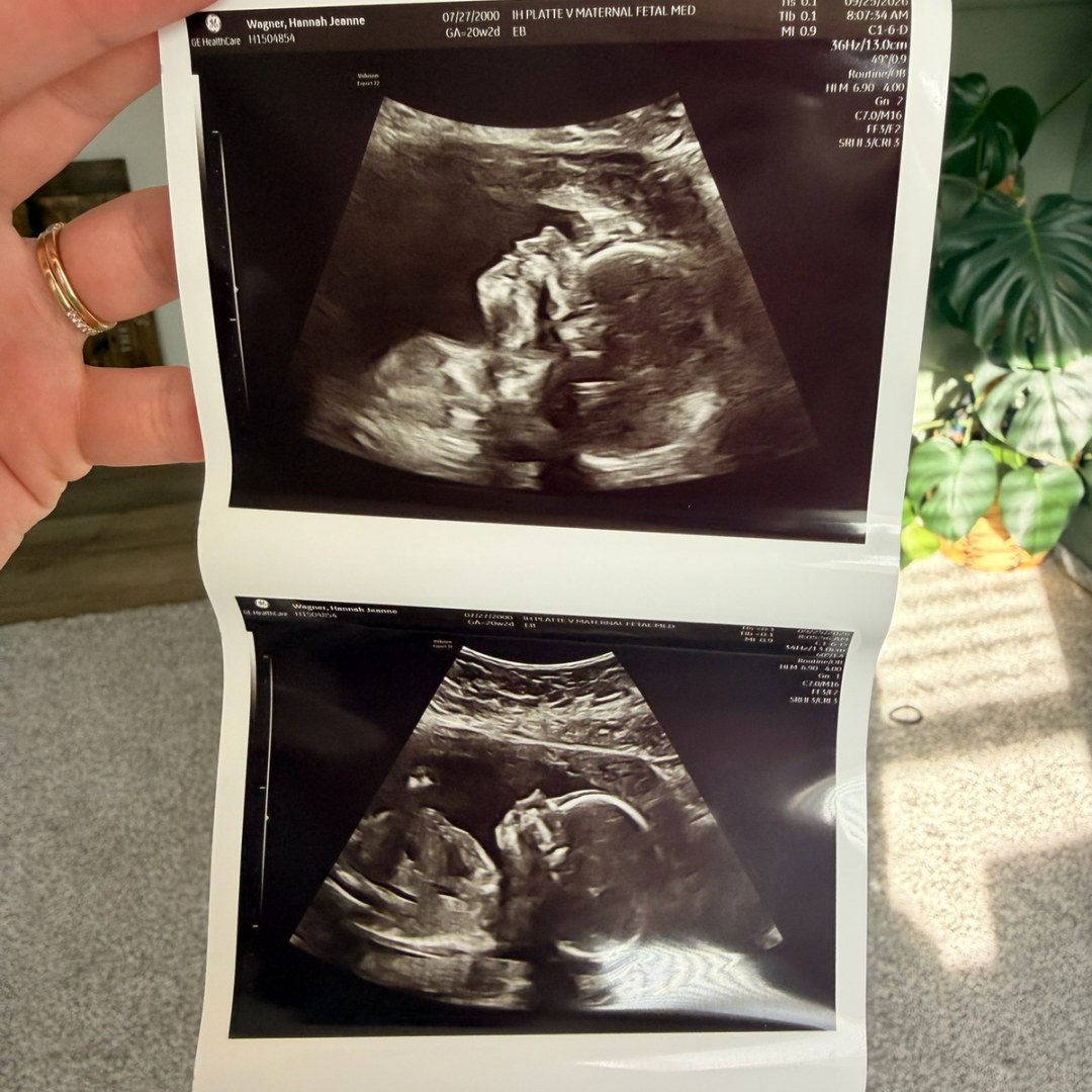 Photo shared by Hannah for their Babylist baby registry.